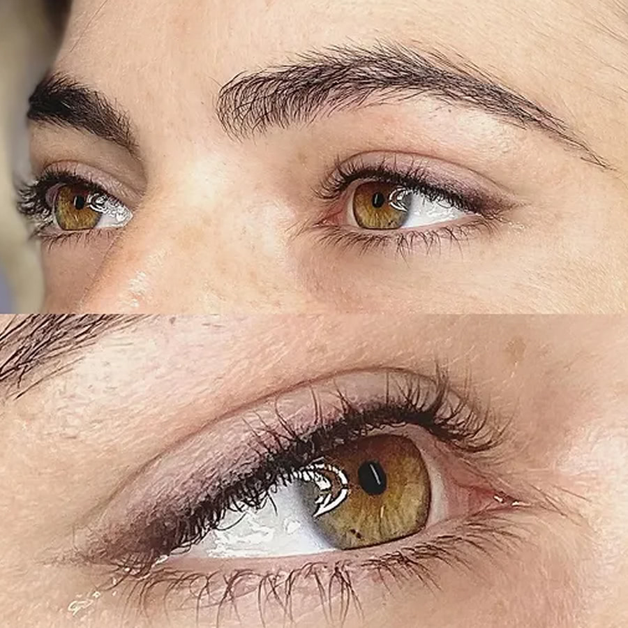 Cosmetic Eyelid Tattooing